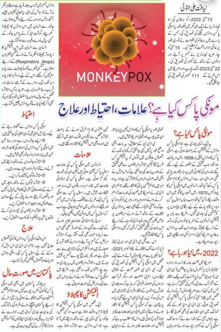 Monkeypox Guide in English & Urdu, Symptoms, Vaccine, Treatment, Causes, Precautions